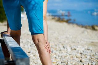 Varicose veins of the lower limbs from physical exertion