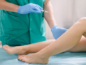 The treatment of varicose veins